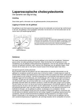 Laparoscopische cholecystectomie.pdf - Tjongerschans