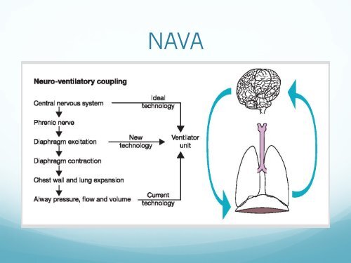 TOPICS 2012 Neurally Adjusted Ventilatory Assist - Topics in ...