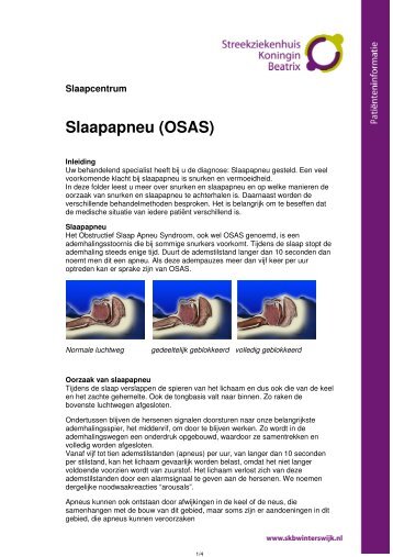 Slaapapneu (OSAS) - Streekziekenhuis Koningin Beatrix