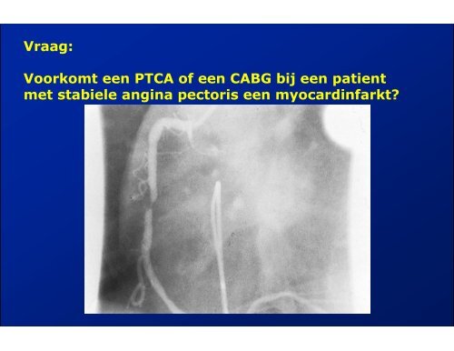 ACUTE CORONAIRE SYNDROMEN - ICverpleegkundige.com