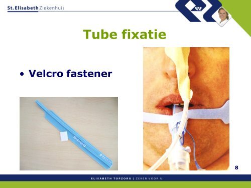 Tube fixatie - Topics in Intensive Care