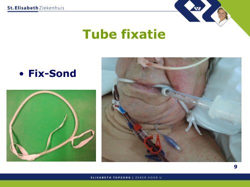 Tube fixatie - Topics in Intensive Care