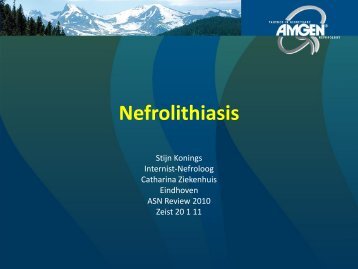 Nefrolithiasis
