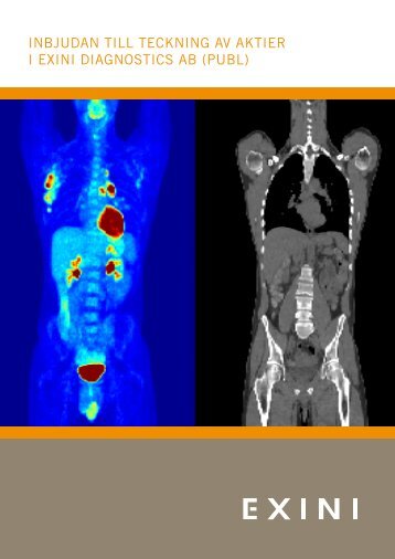 inbjudan till teckning av aktier i exini diagnostics ab (publ)