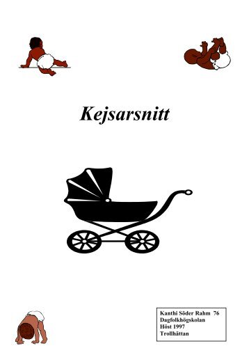 Kejsarsnitt