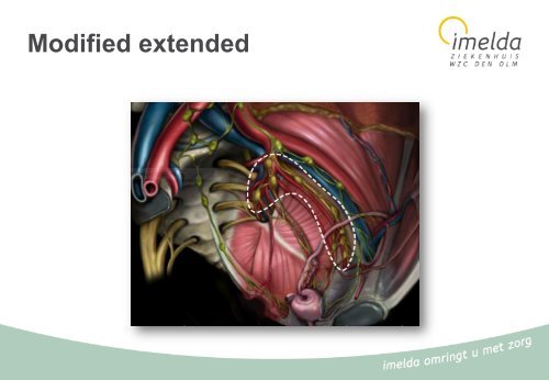 06 - Urologie - prostaatcarcinoma - Imelda