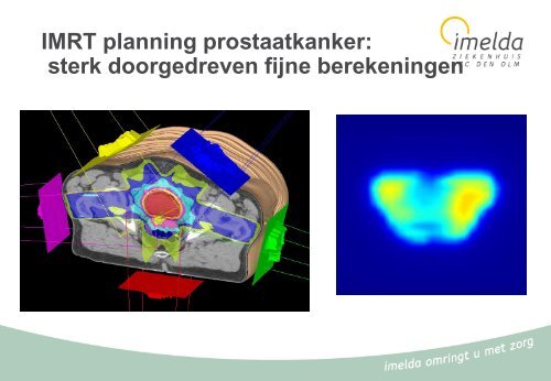 06 - Urologie - prostaatcarcinoma - Imelda