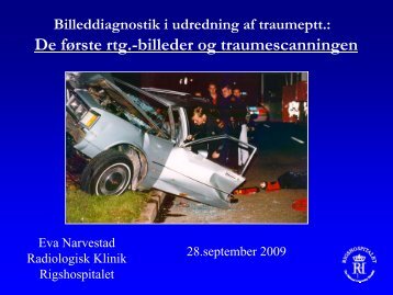 De første rtg.-billeder og traumescanningen - a-kursus.dk