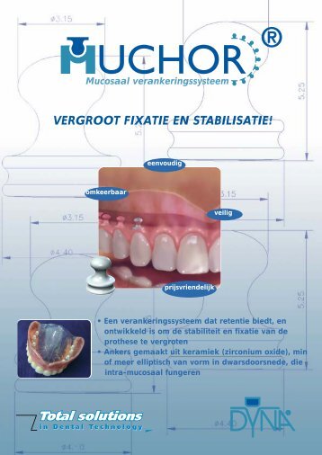 Muchor leaflet A4-Ned - Dyna Dental