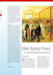 Niels Ryberg Finsen – en dermatologisk redningsmand - Oftalmolog