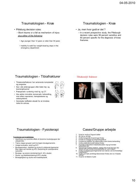 Ligamenterne Anatomi - Menisk Anatomi - biomekanik