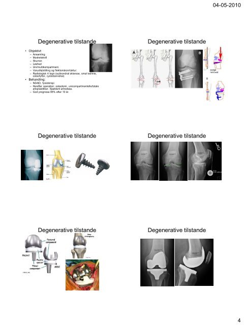 Ligamenterne Anatomi - Menisk Anatomi - biomekanik