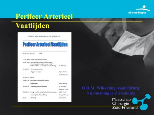 Perifeer Arterieel Vaatlijden - Vaatchirurg