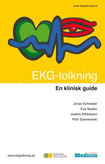 EKG-tolkning – en klinisk guide