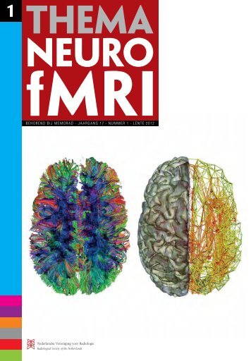 Thema: Neuro-fMRI - Nederlandse Vereniging voor Radiologie