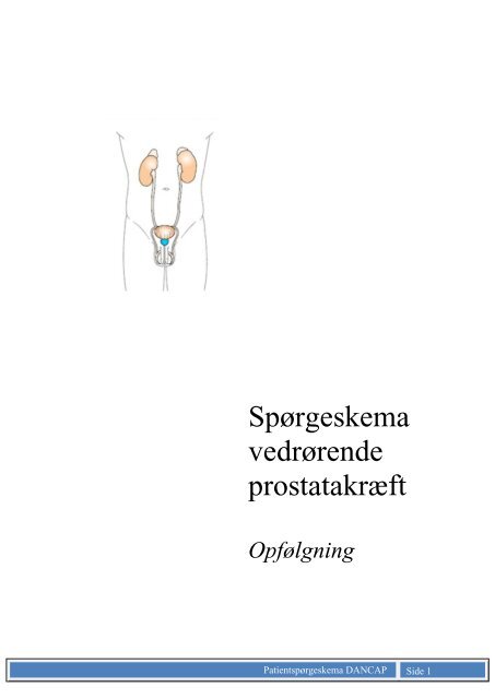 Patientspørgeskema - KCKS-vest