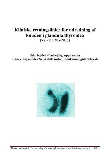 Kliniske retningslinier for udredning af knuden i glandula thyroidea