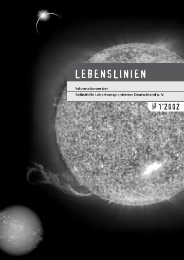 1/2002 - u.a. Budd-Chiari-Syndrom, Leberdialyse - Aktuell ...