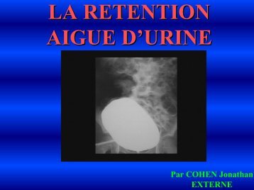 Rétention aigue d'urine - Service d'Urologie CHU Henri Mondor