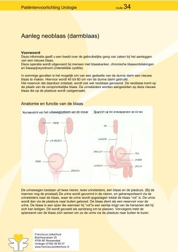 Aanleg neoblaas (darmblaas) - Franciscus Ziekenhuis