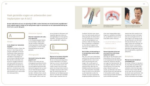 Hoe implantaten uw leven kunnen veranderen - Implants For Life