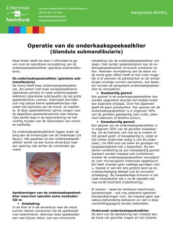 Onderkaakspeekselklier operatie - Ziekenhuis Amstelland