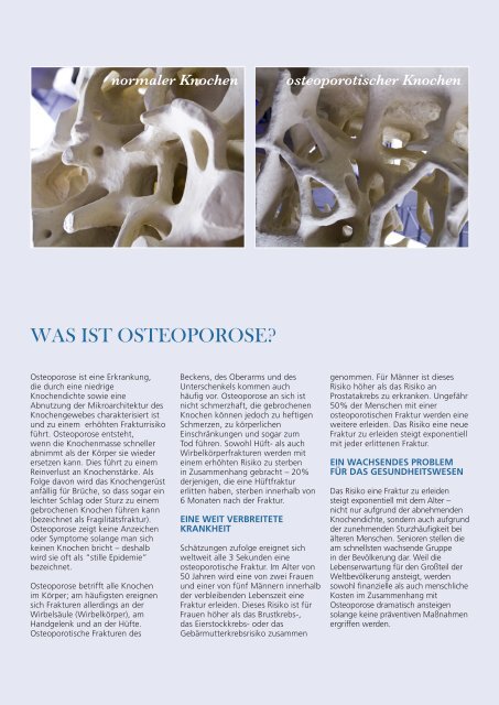 IOF-Report 2012 - International Osteoporosis Foundation