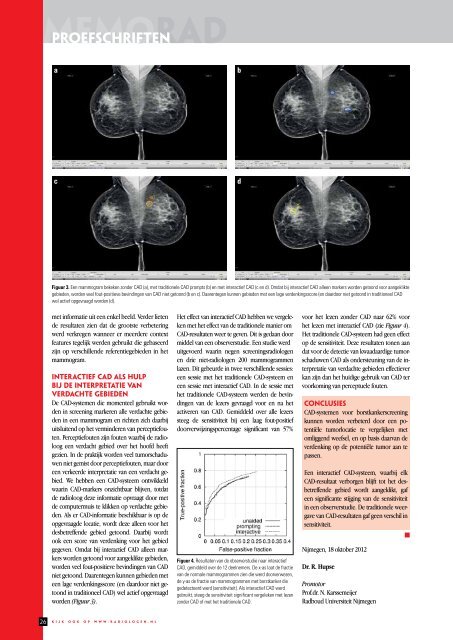 MemoRad 2012-4 - Nederlandse Vereniging voor Radiologie