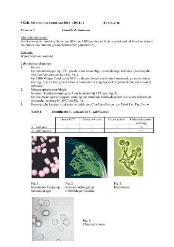 SKML Mycologie februari 2004 Evaluatie.pdf