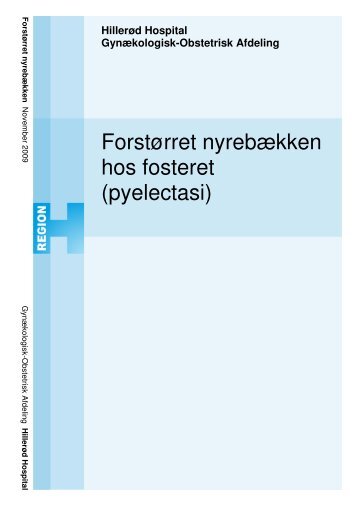 Forstørret nyrebækken hos fosteret (pyelectasi)