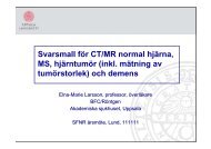 Skalle - Normal CT, MS, hjärntumör, demens (PDF) - SFNR
