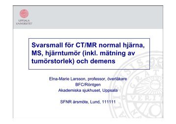 Skalle - Normal CT, MS, hjärntumör, demens (PDF) - SFNR