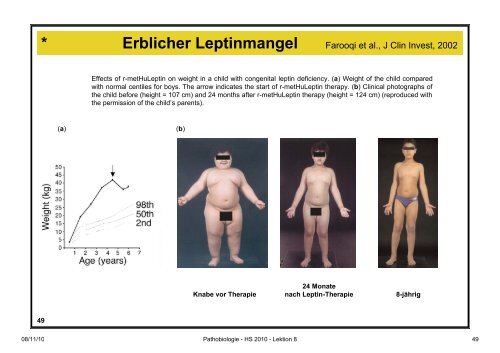 Pathobiologie/Pathobiochemie Teil 2 Lektion 8 8.11.10 ... - Alex Eberle