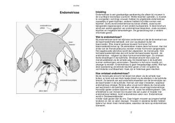 Endometriose - Rivas