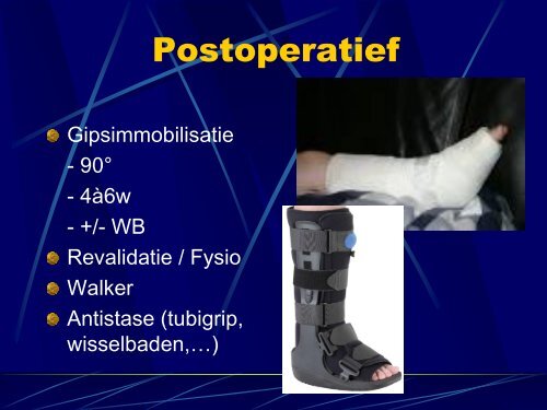 Trauma van de enkel - Orthopedie-web.be