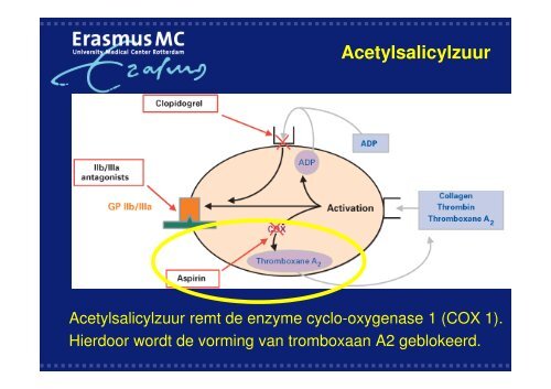 Antistolling bij cardiologische interventies - WES-Rotterdam