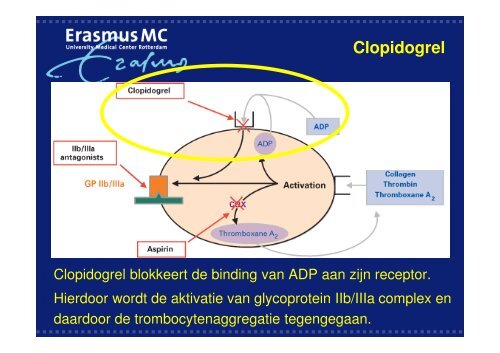 Antistolling bij cardiologische interventies - WES-Rotterdam