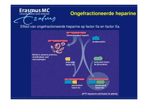 Antistolling bij cardiologische interventies - WES-Rotterdam