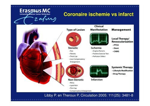 Antistolling bij cardiologische interventies - WES-Rotterdam