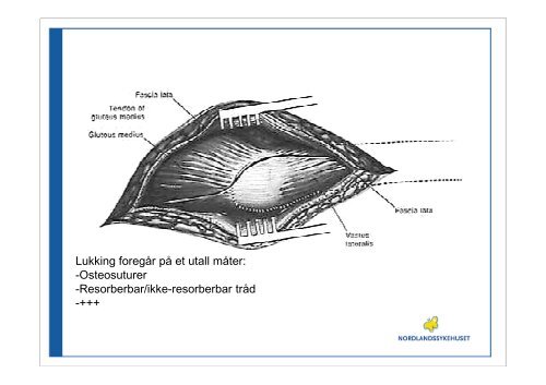 Cato Kjærvik, overlege kir/ort klinikk, Nordlandssykehuset Vesterålen