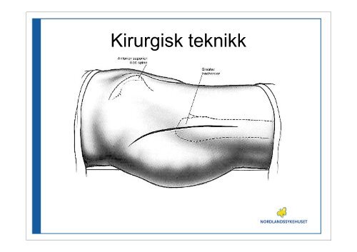 Cato Kjærvik, overlege kir/ort klinikk, Nordlandssykehuset Vesterålen