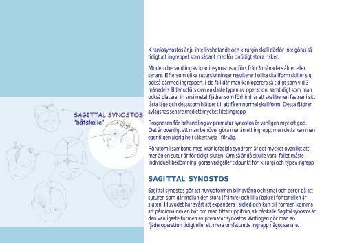 raniofaciala missbildningar - Senter for sjeldne diagnoser