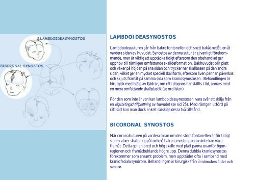 raniofaciala missbildningar - Senter for sjeldne diagnoser