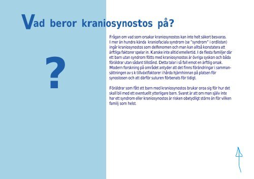 raniofaciala missbildningar - Senter for sjeldne diagnoser