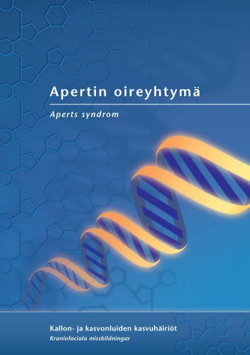 Apertin oireyhtymä - Kallon-ja kasvonluiden kasvuhäiriötä ...