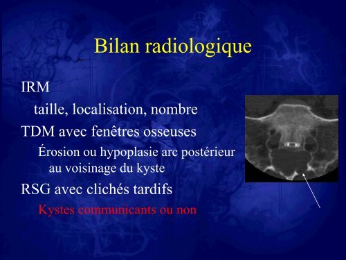 Les kystes de Tarlov. Stratégies thérapeutiques et résultats - sifud-pp