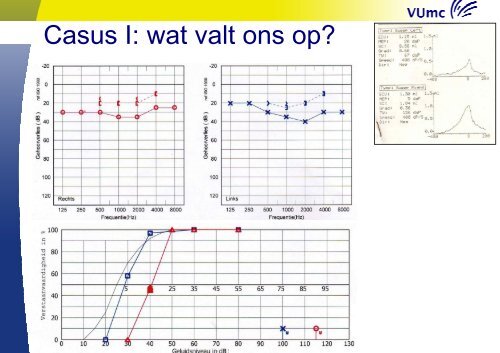 Aggravatie - Ned Ver Audiologie(*)