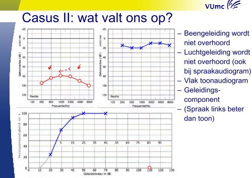 Aggravatie - Ned Ver Audiologie(*)