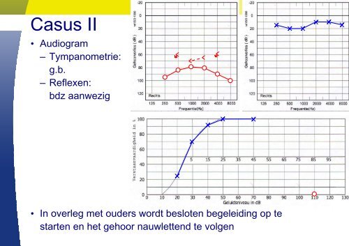 Aggravatie - Ned Ver Audiologie(*)