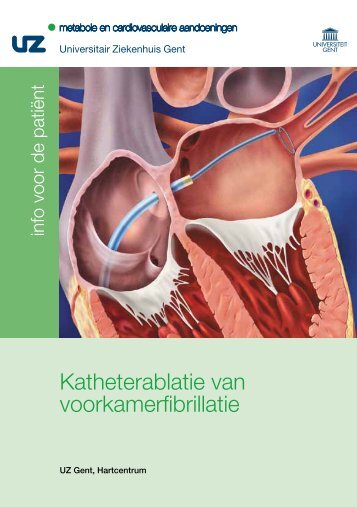Katheterablatie van voorkamerfibrillatie - UZ Gent